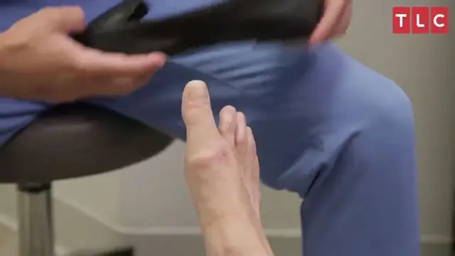 jempol kaki langka