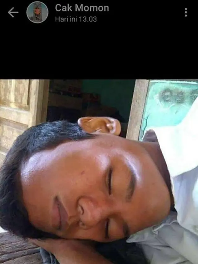 6 Foto Absurd Kepala Orang 'Ngebug' Ini Kelihatan Seram, Kocak