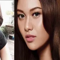 Tahi Lalat Raib, Aurel Hermansyah Makin Cantik.