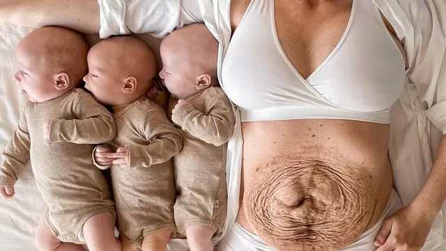 Wanita ini Bagikan Momen Kehamilannya dengan Bayi Kembar 3