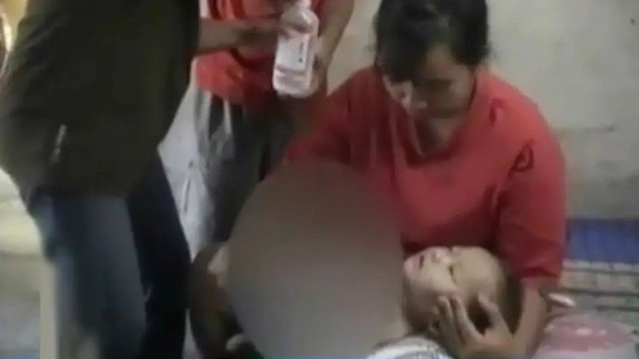 Bayi-Derita-Kanker