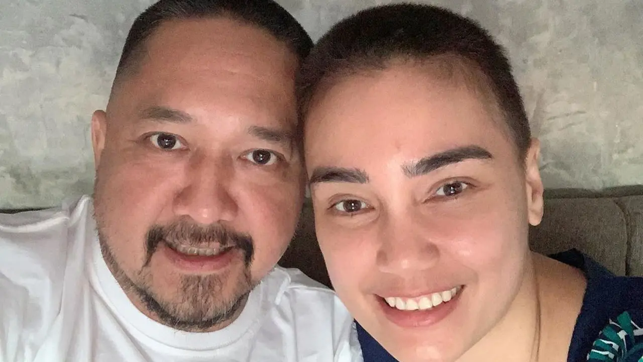 6 Potret Terbaru Feby Febiola Usai Jalani Kemoterapi, Kini Botak