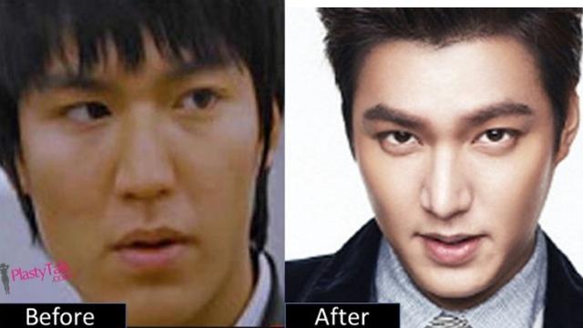 Lee Min Ho Masih Wamil Kabar Operasi Plastik Justru Beredar Luas Showbiz Liputan6 Com