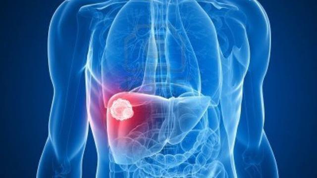 7 Penyakit Hati yang Perlu Diwaspadai, Kenali Gejala dan Cara Pencegahannya