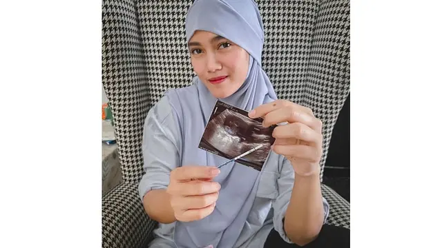 Keguguran Ketiga Kalinya, Ini 6 Potret Perjalanan Kehamilan Jess Amalia