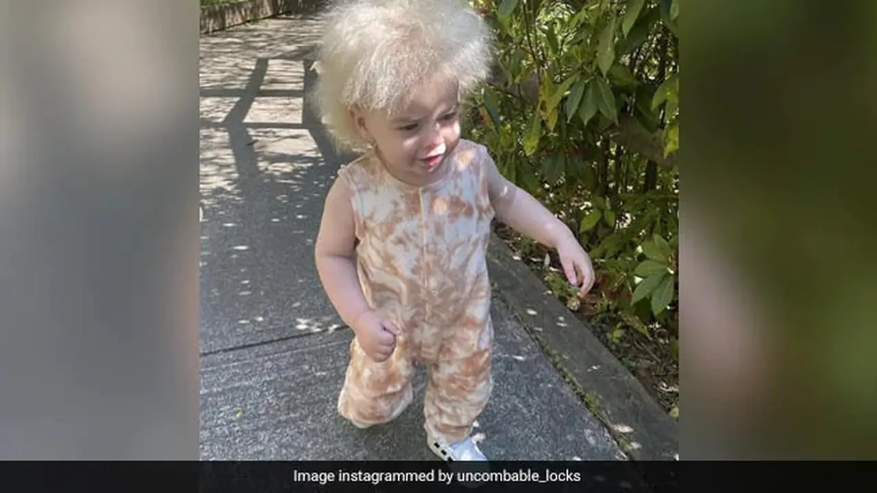 Layla Davis yang berusia 18 bulan didiagnosis dengan awal bulan Juli 2022. (Instagram/uncombable_locks)