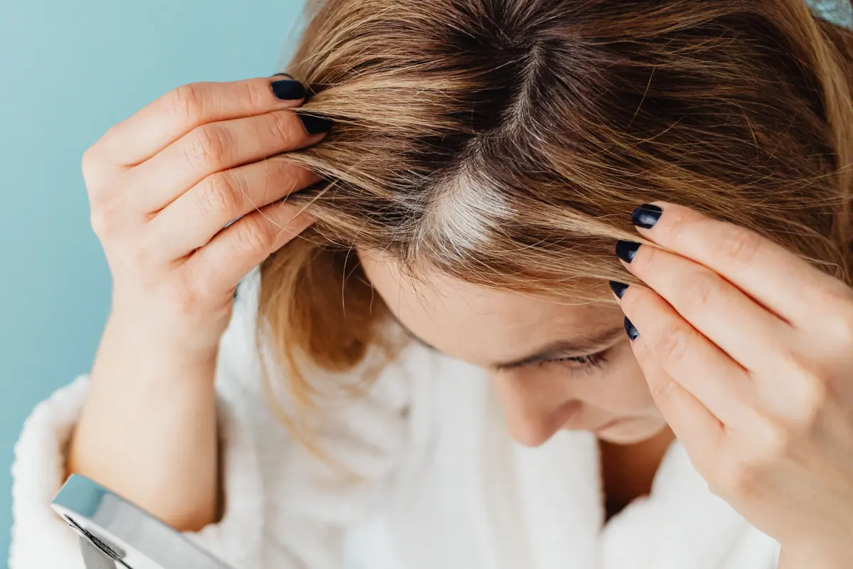 Tips Merawat Rambut Berketombe agar Tetap Sehat dan Lembap