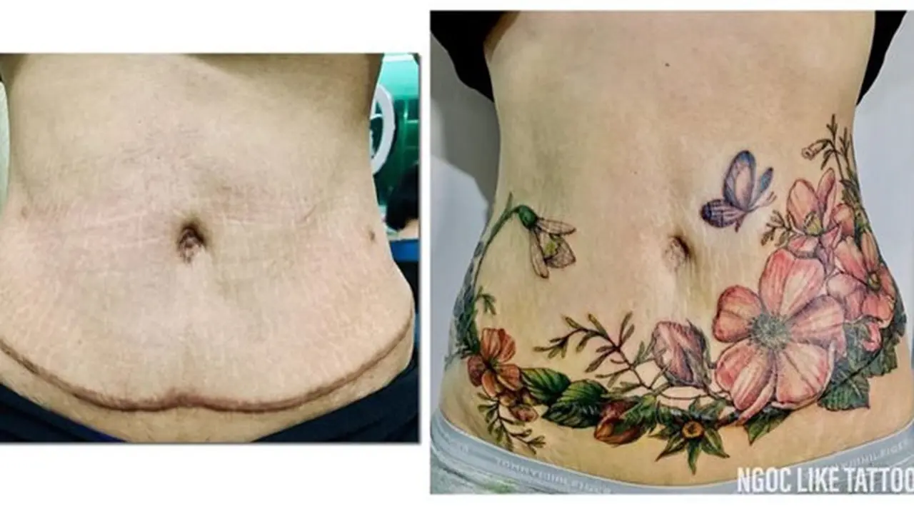 7 Potret Tato Keren Sulap Bekas Luka Jadi Seni Indah