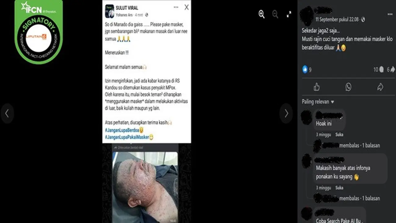 Gambar tangkapan layar kabar tentang ada pasien mpox yang dirawat di RS Kandou, Manado. (sumber: Facebook)