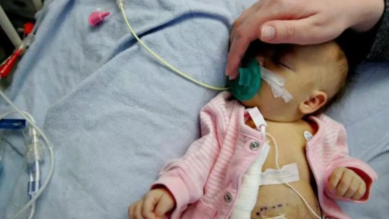 Di AS, Jumlah Bayi Lahir dengan Organ di Luar Tubuh Meningkat