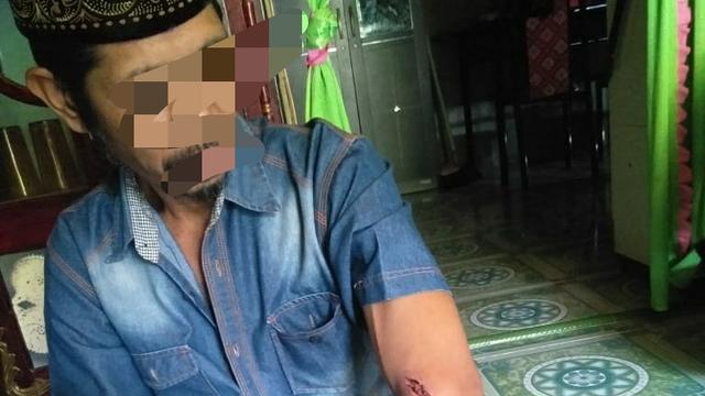 Korban gigitan anjing gila di Kolaka Utara, seorang petani yang dirawat di rumah sakit.(Liputan6.com/Ahmad Akbar Fua)