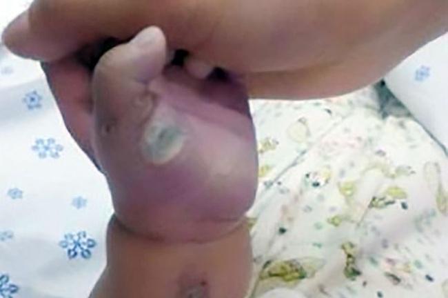 Terdapat luka di tangan bayi yang meninggal karena tersengat listrik | Photo: Copyright mirror.co.uk
