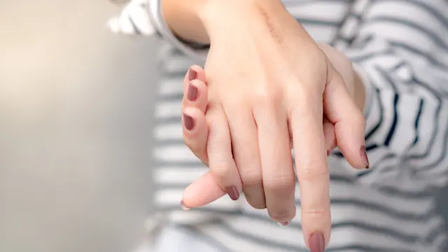 Manfaat Mederma® Advanced Gel, Bantu Pudarkan Bekas Luka dan Bikin Lebih Percaya Diri