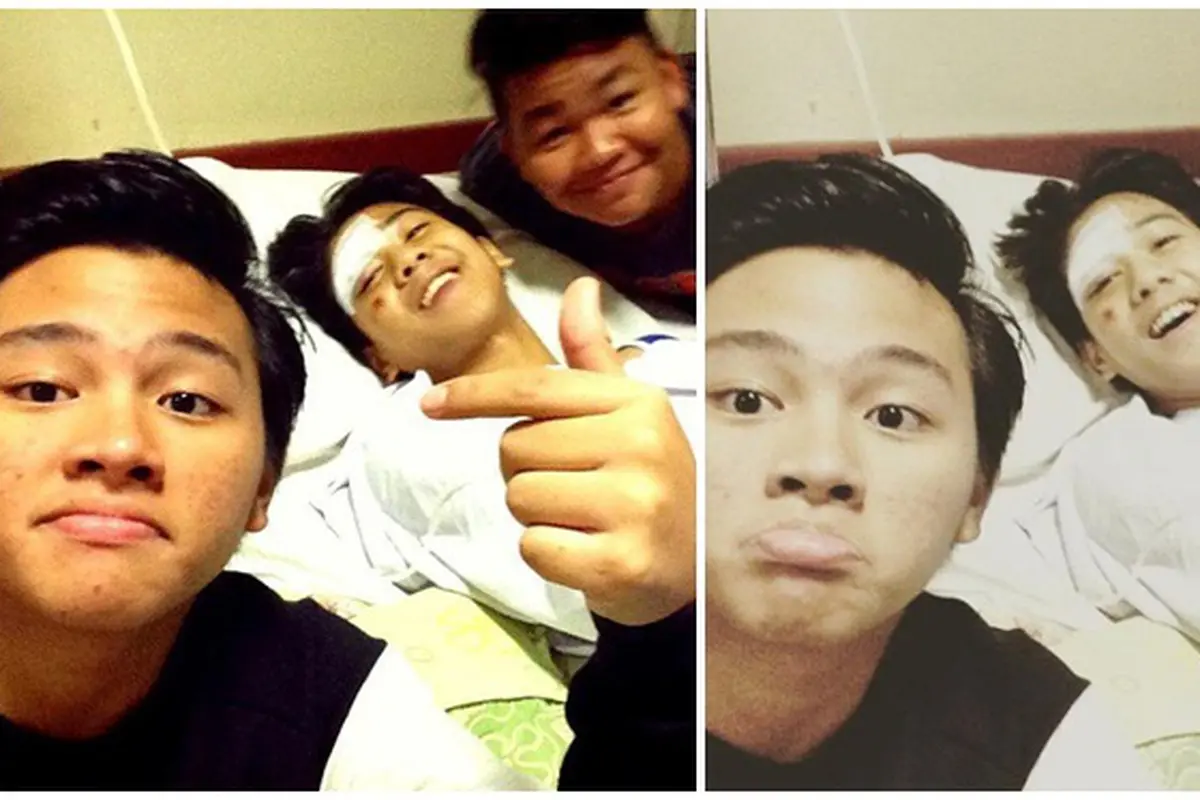 Kondisi Iqbaal CJR kecelakaan
