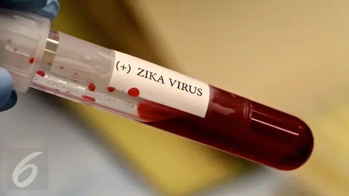 Virus Zika
