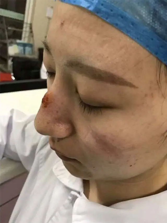6 Potret Wajah Suster Rawat Pasien Virus Corona Ini Bikin Haru