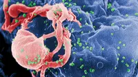 Virus HIV. Tim ilmuwan tidak dapat memastikan 100 persen bahwa mutasi itulah yang menyebabkan kekebalan terhadap HIV. (Sumber CDC)