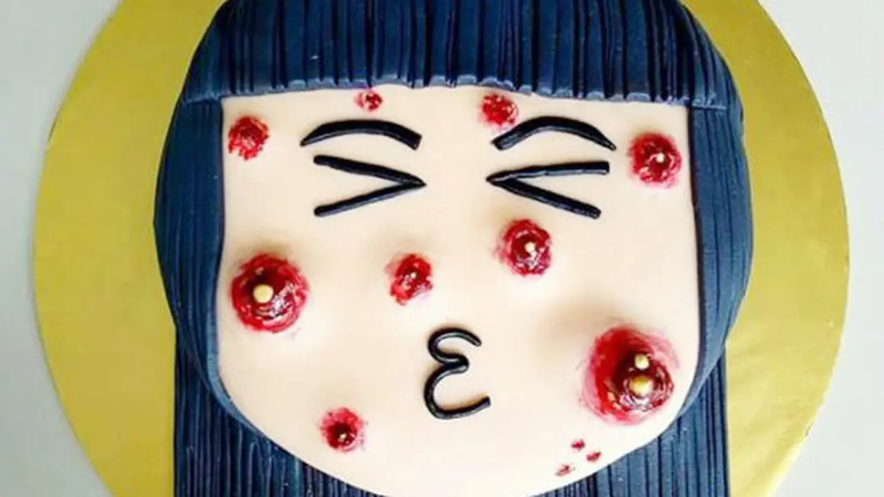 Cake Jerawat, Kue Unik yang Bikin Geli Sekaligus Penasaran