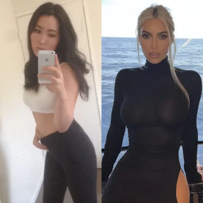 Cerita Perempuan Korea Lakukan 15 Operasi Plastik Agar Mirip Kim Kardashian