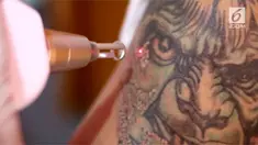 Layanan menghapus tato gratis dalam rangka menyempurnakan ibadah dikunjungi warga.