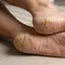 Bebas Tumit Pecah-Pecah, Coba 5 Tips Ampuh Mengembalikan Kelembutan Kulit Kaki