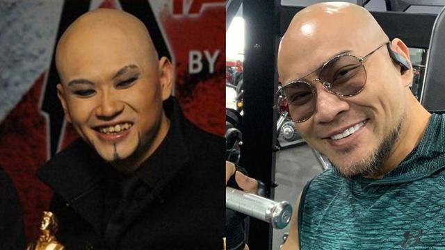 6 Transformasi Seleb Setelah Perbaikan Gigi, Terbaru Elly Sugigi