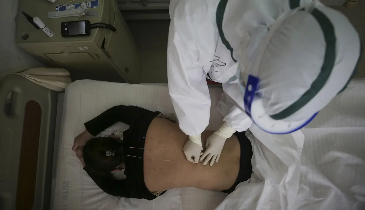 Pasien terinfeksi virus corona COVID-19 menerima perawatan akupunktur di Rumah Sakit Palang Merah di Wuhan, China (11/3/2020). Peningkatan kasus virus corona di China memicu kekhawatiran bahwa infeksi dari luar negeri dapat merusak kemajuan dalam menghentikan penyebaran virus tersebut. (AFP/STR)