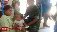 Panik Dengar Suara Teriakan, Kera Liar Cakar Wajah Balita di Probolinggo