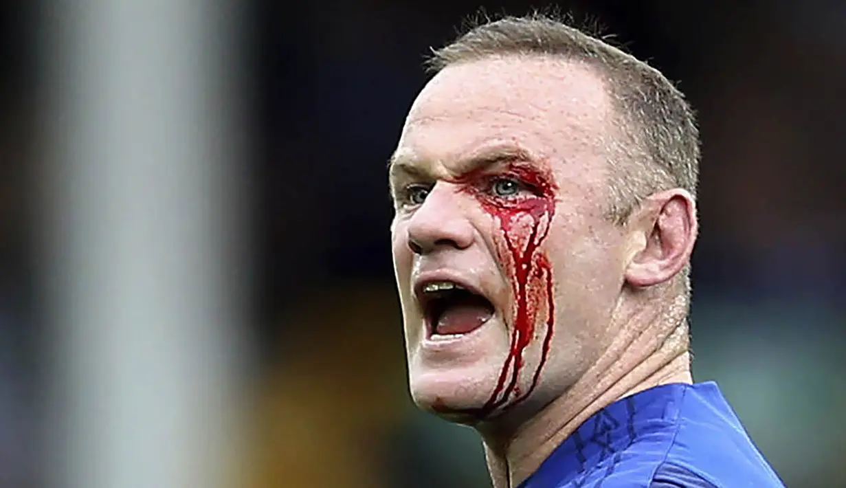 Striker Everton, Wayne Rooney, mengalami pendarahan di mata kirinya usai duel udara dengan bek Bournemouth, Simon Francis, pada Premier League, di Stadion Goodison Park, Sabtu (23/9/2017). Everton menang 2-1 atas Bournemouth. (AP/Barrington Coombs)