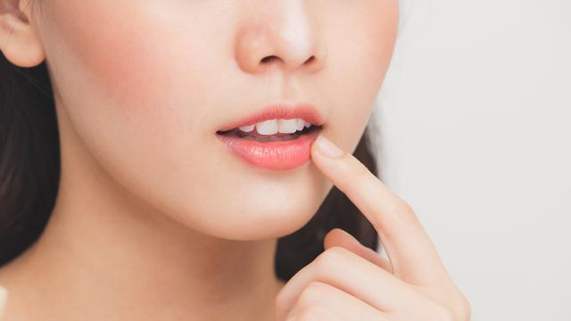 bibir pecah-pecah