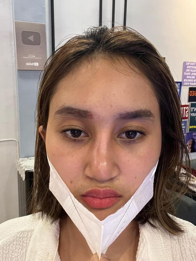 Sempat Oplas, Ini 6 Potret Permesta Dhyaz Anak Farida Nurhan Alami Infeksi Implan