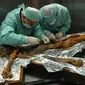 Makanan terakhir yang dikonsumsi manusia gunung Otzi kaya dengan lemak. (Eurac Research Institute for Mummy Studies)