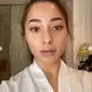 Nikita Willy sempat menangis saat wajahnya penuh jerawat bahkan tak mau menerima pekerjaan (dok.instagram/@nikitawillyofficial94/https://www.instagram.com/p/CONe-G3g17b/Komarudin)