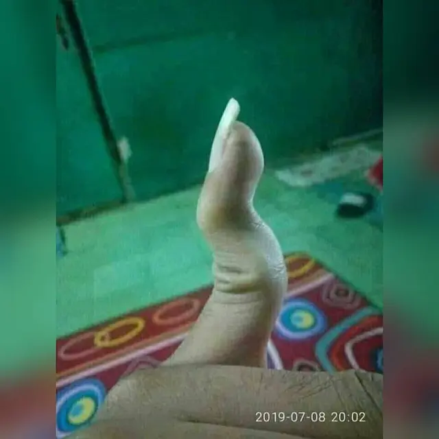 6 Potret Atraksi Jari Tangan, Cuma Melihat Bikin Kram