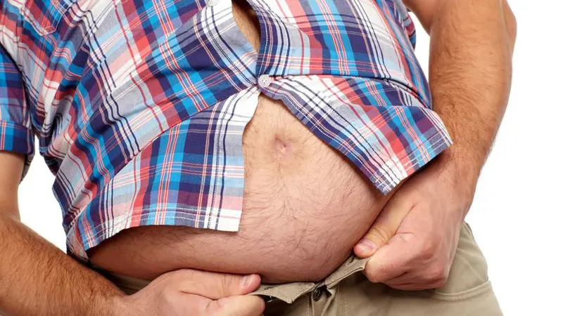Penderita Obesitas Berisiko Terkena Batu Ginjal