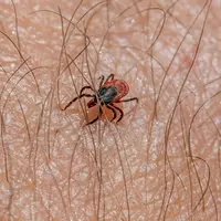 Tanda-tanda penyakit Lyme yang disebabkan dari gigitan kutu. [Dok/pexels.com/erikkarits]