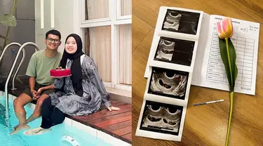 Musdalifah Basri membagikan sebuah foto berisi setangkai bunga, test pack dan hasil USG beserta pemeriksaan kehamilannya. Dalam caption unggahan tersebut, ia juga mengucapkan rasa syukurnya. "Alhamdulillah tahun 2023 diawali dengan kebahagiaan. Doain ya guys," tulisnya. (Liputan6.com/IG/@musdalifahbasri)
