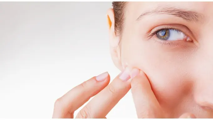 Foto: copyright more.com