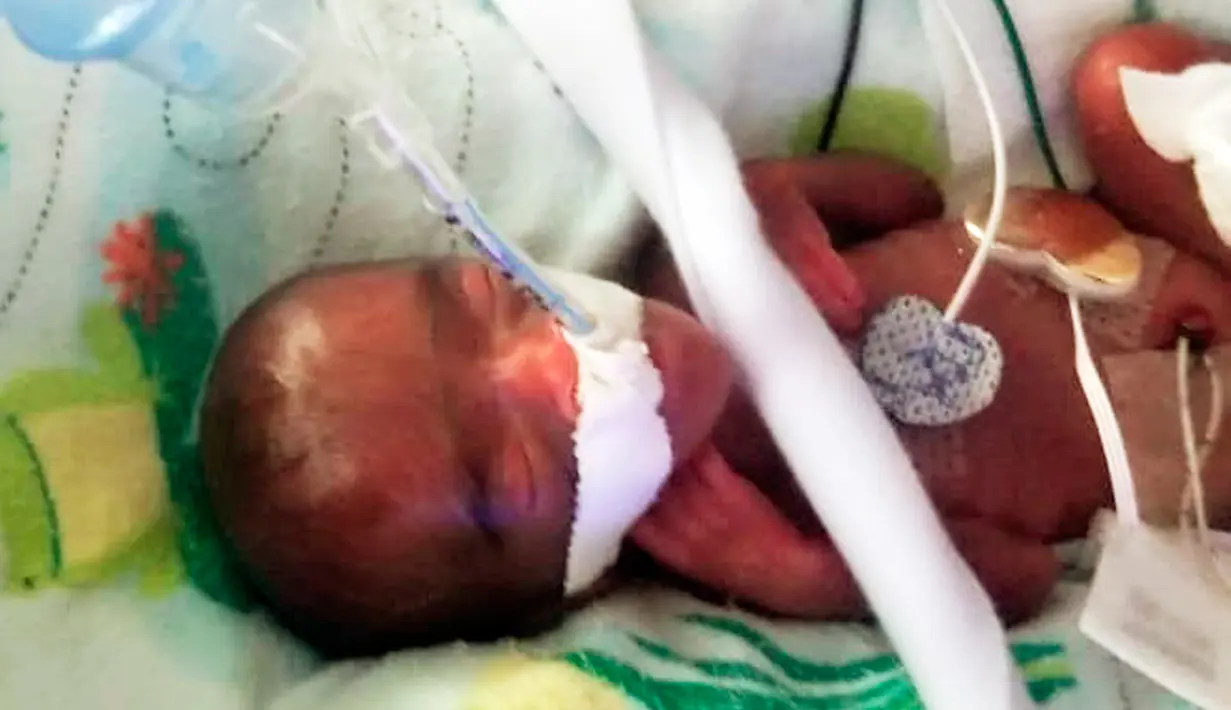 Foto pada Desember 2018 memperlihatkan seorang bayi yang dipanggil dengan nama Saybie. Bayi perempuan itu lahir dengan berat 245 gram di Rumah Sakit Ibu dan Anak Sharp Mary Birch, kata rumah sakit itu saat mengumumkan kelahiran dan kepulangan Saybie pada Rabu (29/5). (Sharp HealthCare via AP)