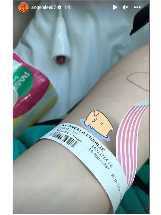 6 Potret Kondisi Angela Lee Pasca Alami Kecelakaan Mobil di Tol, Kaki Dipasang Pen
