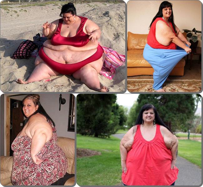 Patty, wanita dengan berat badan 330 kg turun 100 kg | Photo: Copyright metro.co.uk 