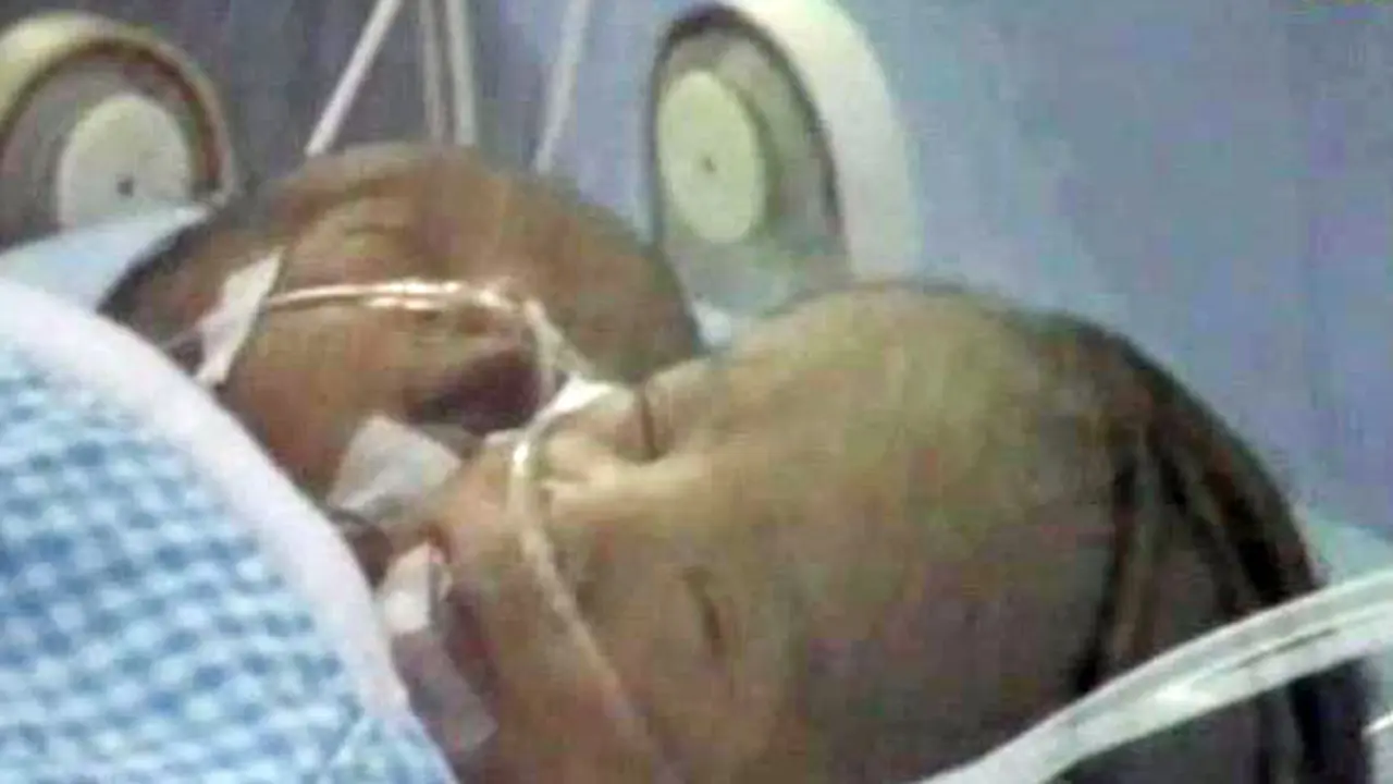 BAYI KEPALA 2