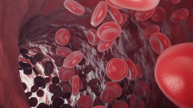 Kenali Sepsis, Infeksi Darah yang Menyerang George H. W. Bush (Rost9/Shutterstock)
