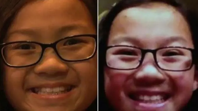 Si Kembar yang Terpisah 10 Tahun Lamanya Telah Bertemu, Haru!