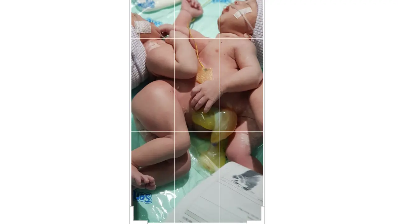 Ilustrasi-Jasad-Bayi