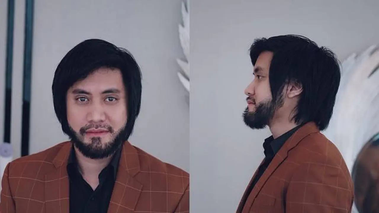 6 Potret Terbaru Kevin Aprillio Usai 7 Bulan Transplantasi Rambut, Makin Maskulin