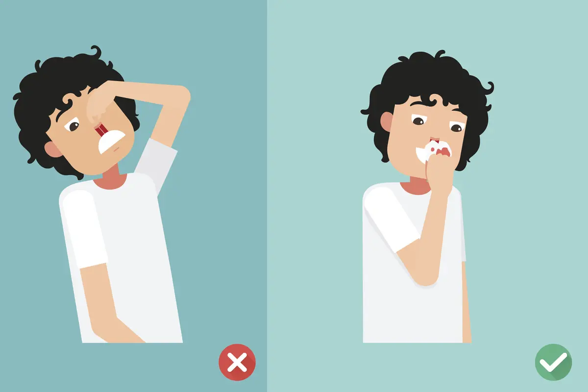Ilustrasi Mimisan (iStockphoto)