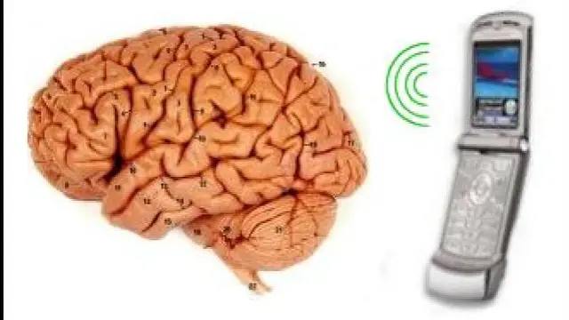 Satu Lagi Ilmuwan yang Sebut Radiasi HP Bikin Kanker Otak