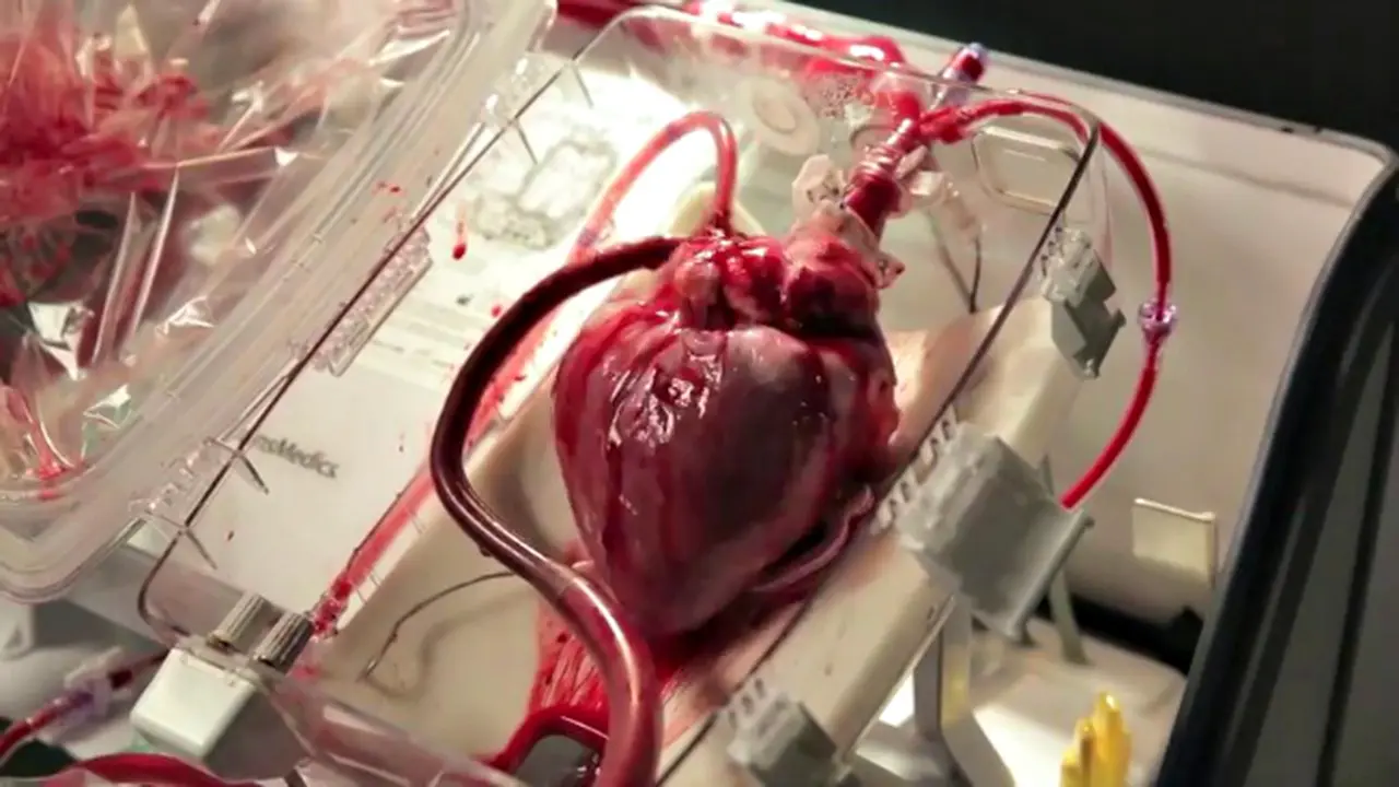 Donor Jantung Ini Masih Berdegup Ketika Dikirimkan ke Penerima
