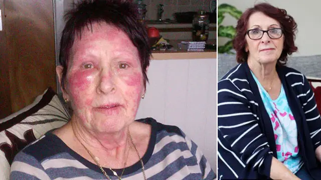 Marlene Corrall | Foto: Dailymail.co.uk